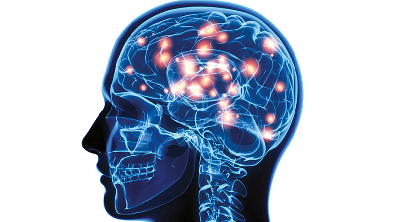 Brain Before Dead