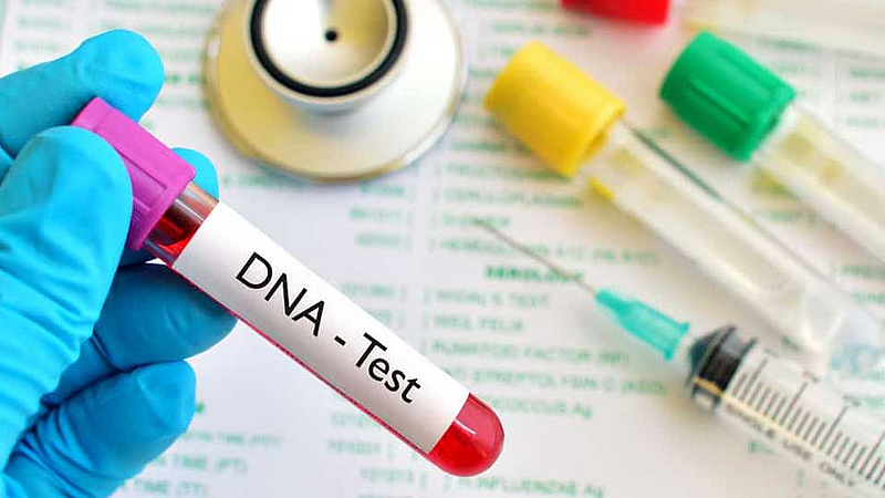 DNA test