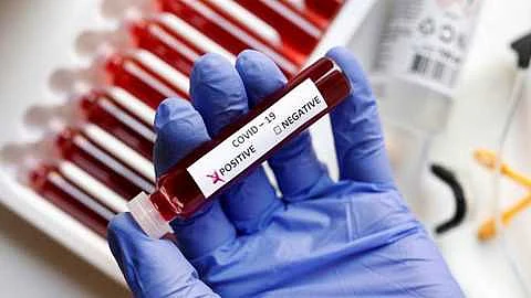 सोलापूर जिल्ह्यात संस्थात्मक विलगीकरण होणार ज्या-त्या गावातच