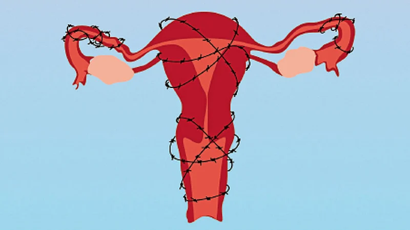 endometriosis