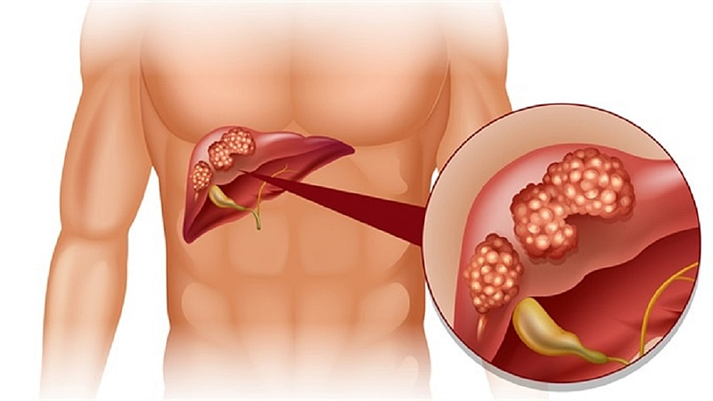 liver