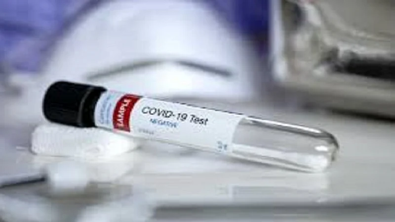 Corona tested after coming in contact with Vaibhav Naik All administer report negative