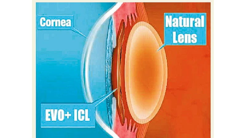 Successful surgery is done by Pune ophthalmologists