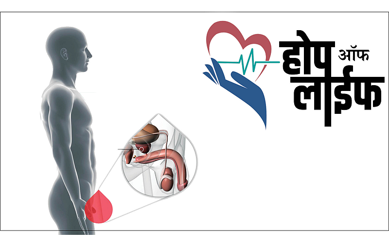 #HopeOfLife : पुरःस्थ ग्रंथीचा कर्करोग!