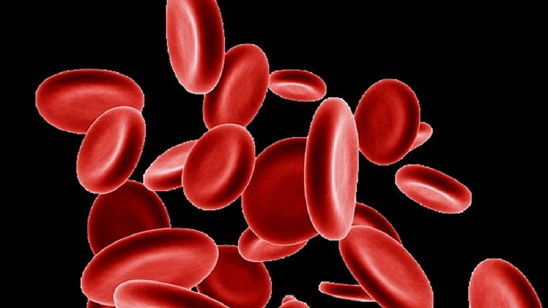 anemia