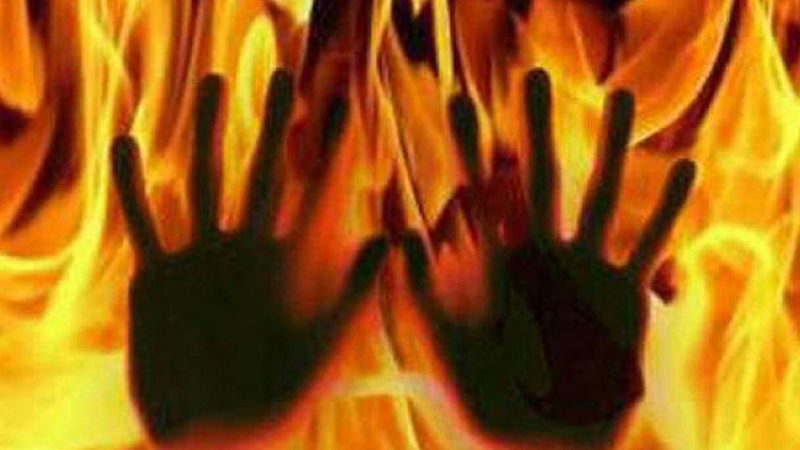 Two days before the wedding, the bride was burnt with petrol