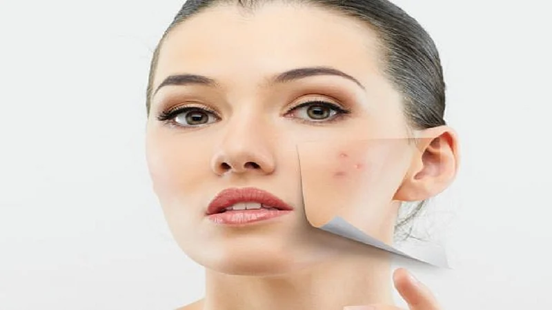 how to reduce pigmentation from the skin know remedies