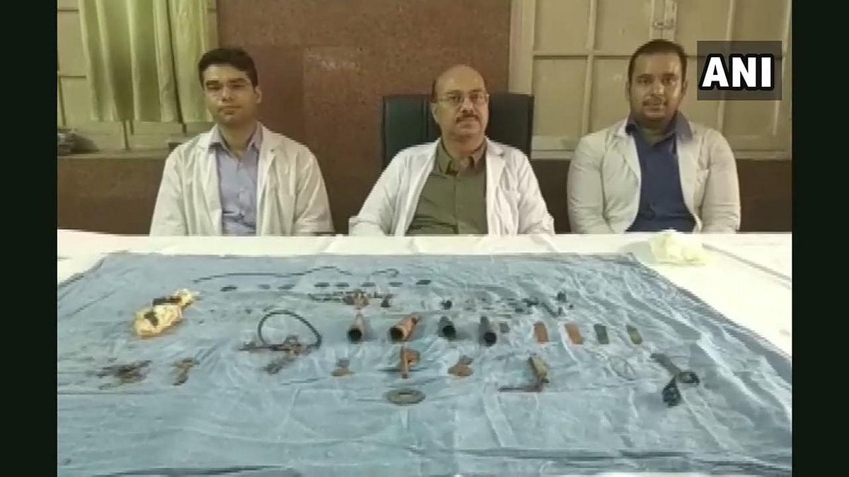 Rajasthan: Doctors remove 80 objects including keys, chains from man's stomach in Udaipur