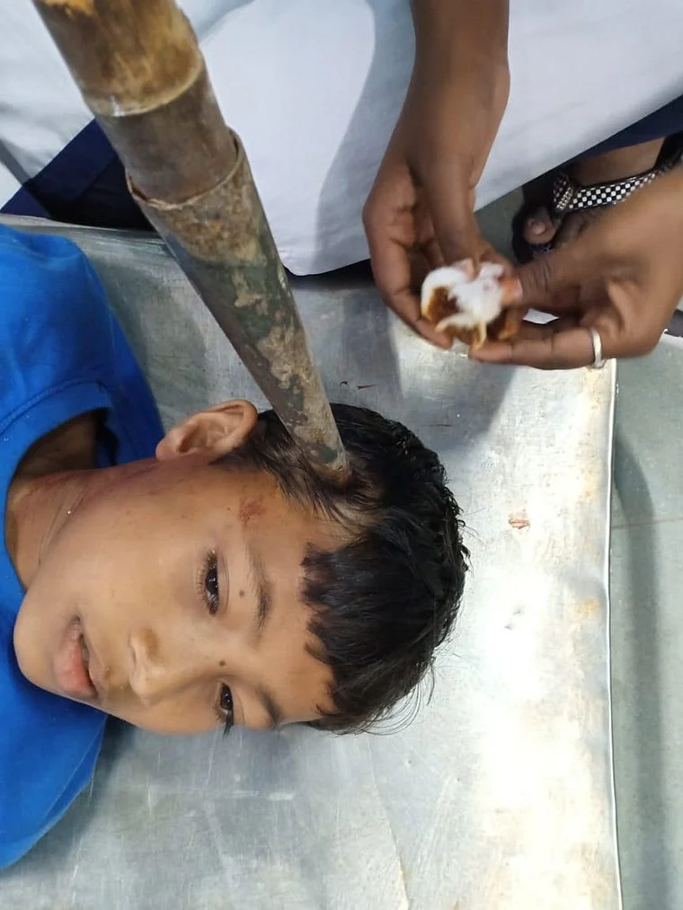 Freak accident: Boy gets struck by javelin on head during annual sports day in Kolkata school