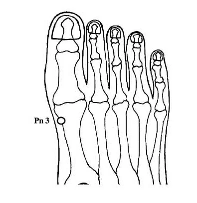 To control diabetes, paste moong beans by using adhesive tape on point Pn 3, which is the third bone of right toe