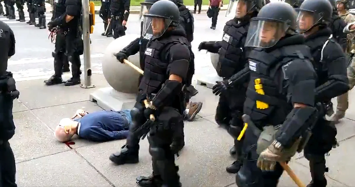 he protester was reported to be in stable but serious condition at a local hospital