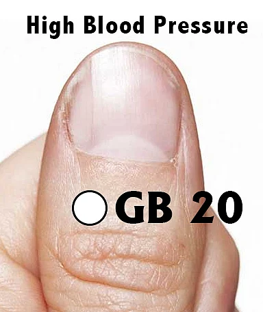 Say goodbye to high blood pressure with Su-Jok