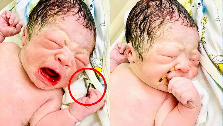 The Chosen One: Baby born holding mum's IUD