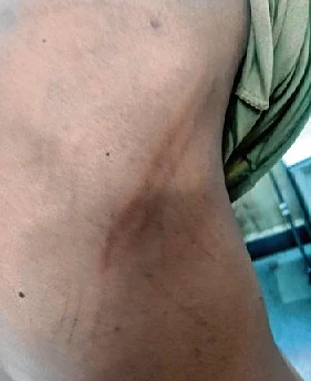 Gujarat cops thrash 3 Dalits, land in soup