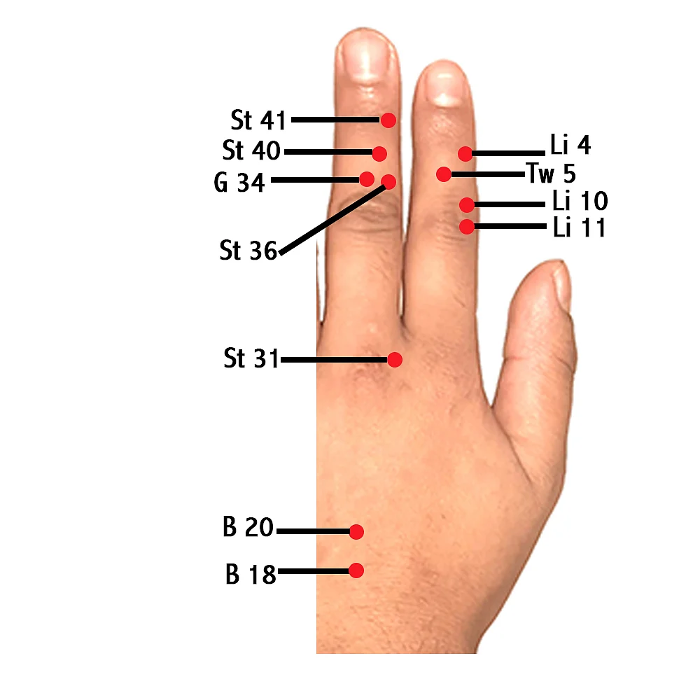 Simply Su-Jok: The Parkinson's problem