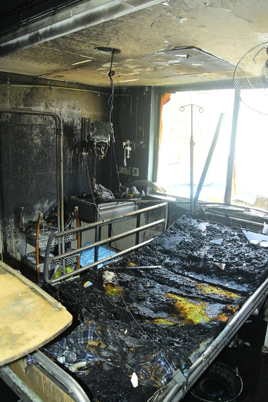 Burned ward of hospital