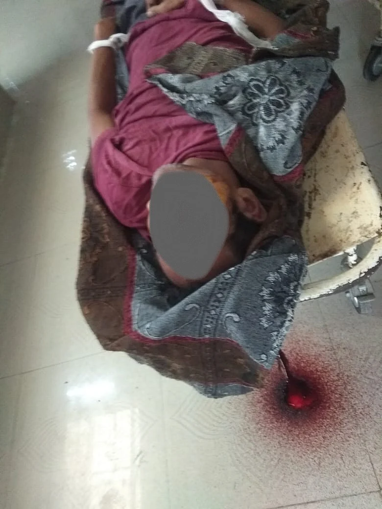 Indore: Shocker at the district hospital as rats nibble dead body in mortuary; No freezer available, body kept under fan