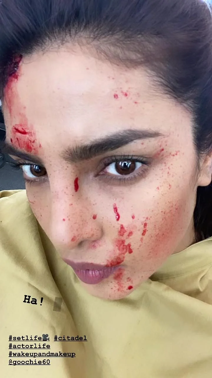 Priyanka Chopra Jonas shares a 'bloody' selfie from 'Citadel' sets