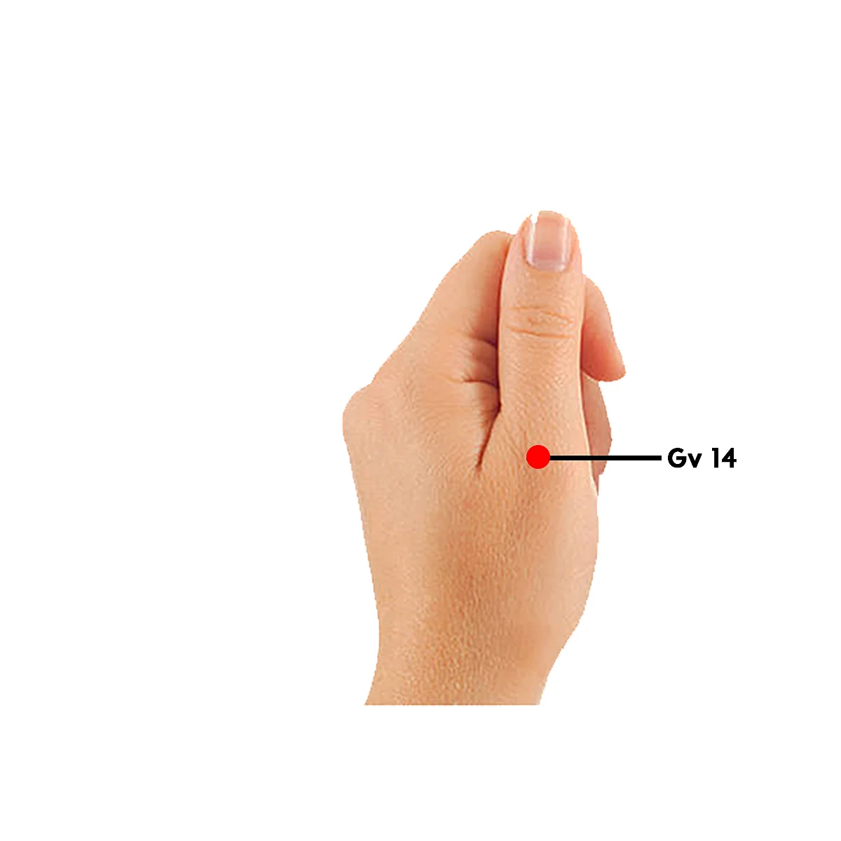 Simply Su-Jok: What is vitiligo and how to manage it?