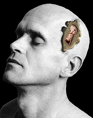 Surgeons successfully remove tumor from brain through hole smaller than a dime