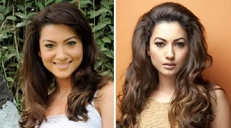 Anushka Sharma to Vaani Kapoor: 10 Bollywood heroines who went under the knife, and got it wrong