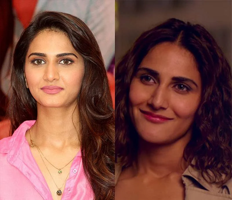 Anushka Sharma to Vaani Kapoor: 10 Bollywood heroines who went under the knife, and got it wrong