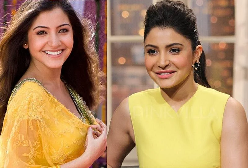 Anushka Sharma to Vaani Kapoor: 10 Bollywood heroines who went under the knife, and got it wrong