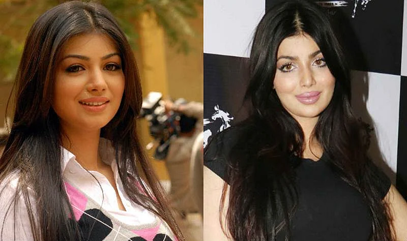 Anushka Sharma to Vaani Kapoor: 10 Bollywood heroines who went under the knife, and got it wrong