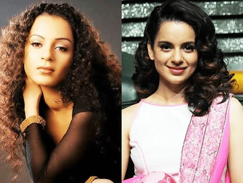 Anushka Sharma to Vaani Kapoor: 10 Bollywood heroines who went under the knife, and got it wrong