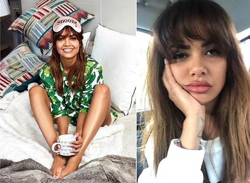 #LipsDontLie: 10 Bollywood actress who have gone under the knife for lip surgery