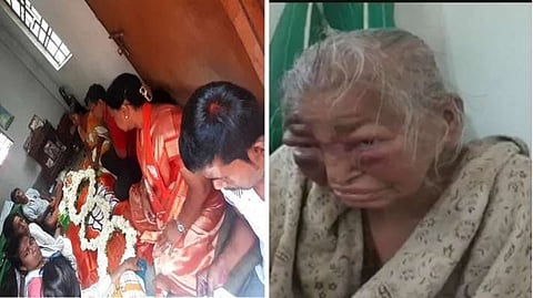 West Bengal: 85-year-old woman, who was allegedly attacked by TMC workers in February, passes away