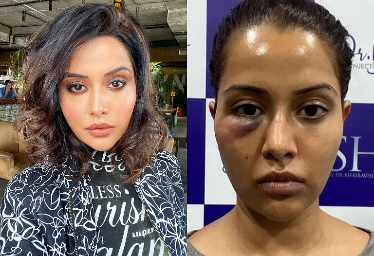 Tamil actress Raiza Wilson blasts dermatologist after treatment goes wrong, says she was 'forced'