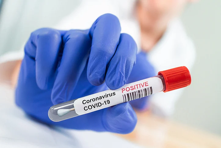 Bengaluru: Authorities on alert after 2 South African nationals test Covid positive amid concerns...