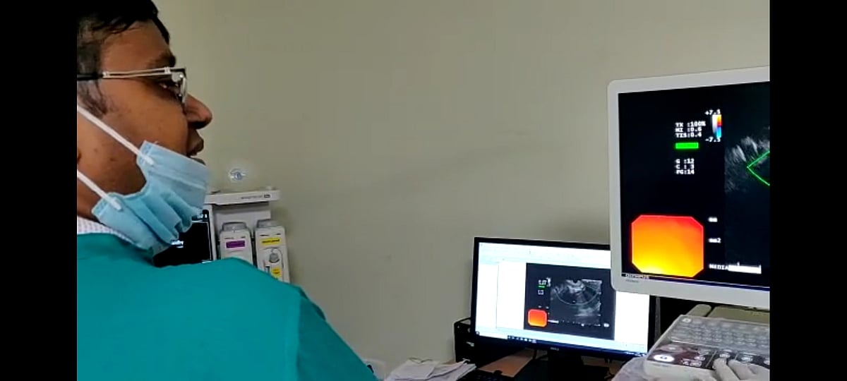 Indore Super Speciality Hospital first govt hospital to have endoscopy ultrasound facility