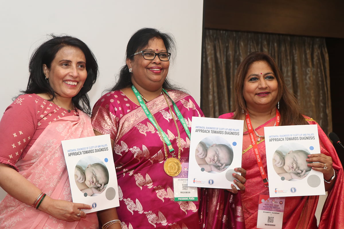 Indore: About 45,000 kids born with cleft lip and palate every year - Vimarsana News