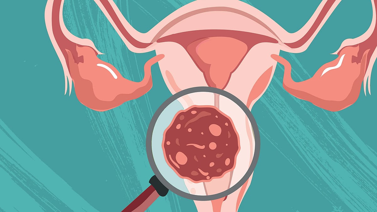 Serum Institute seeks government nod to manufacture vaccine for cervical cancer - Vimarsana News