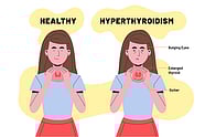Balancing The Thyroid Naturally Naturopathic Doctor Nirvana 55 OFF