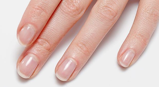 Do you want healthy nails? Stop these 7 habits - Vimarsana News