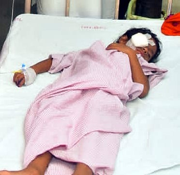 Bhopal:7-year-old girl undergoes surgery after horrific dog attack; doctors assure restoration of eyesight - Vimarsana News