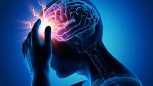 World Stroke Day 2022: Know everything about stroke, risk factors, signs, diagnosis, treatment, and aftermath - Vimarsana News