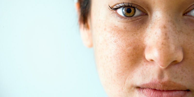 DIY methods for blemish-free skin this winter - Vimarsana News