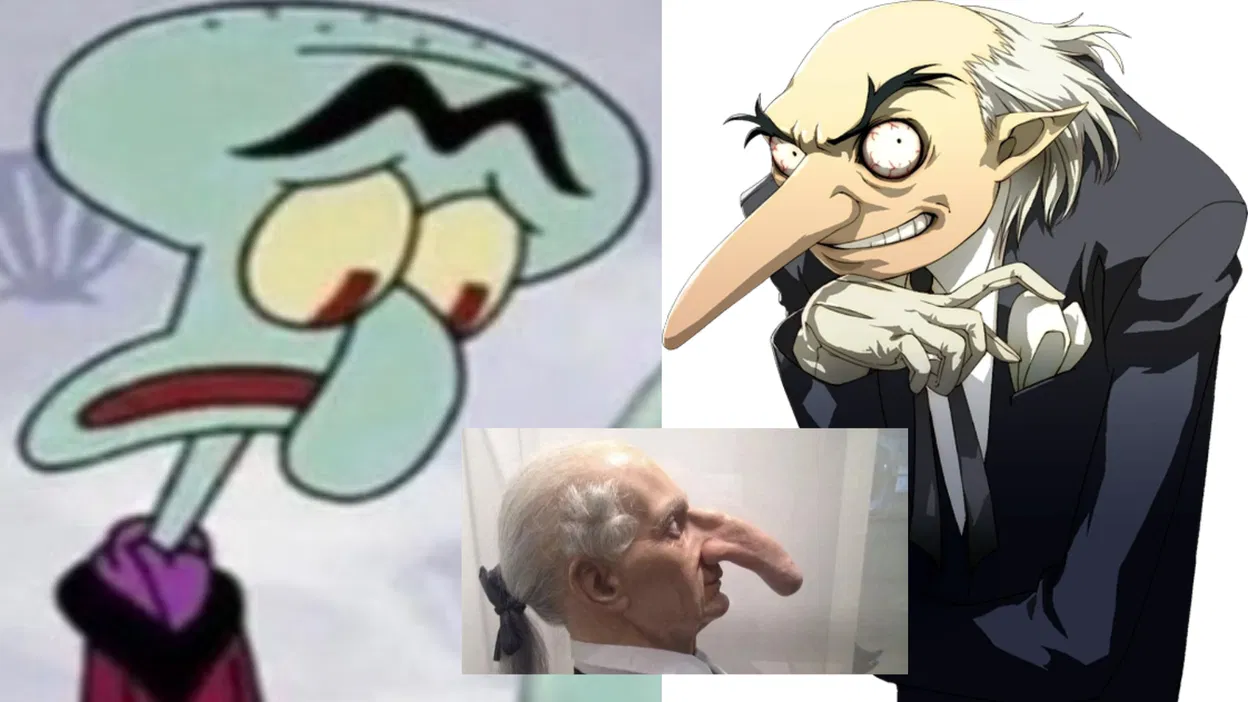 Who is Thomas Wadhouse? The man with 'World's longest nose' reminds  netizens of iconic cartoon characters, goes viral