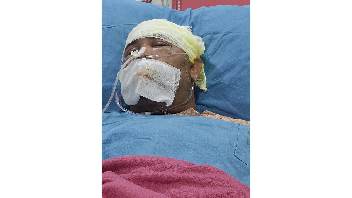 Indore: Marathon treatment saves bee-stung man - Vimarsana News