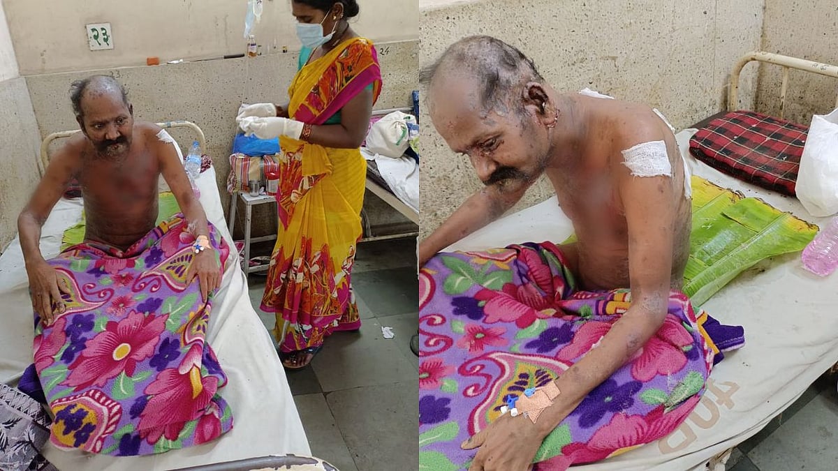 Thane: Kin of patient with autoimmune disease allege mistreatment at civic hospital in Kalwa; doctor refutes claims - Vimarsana News