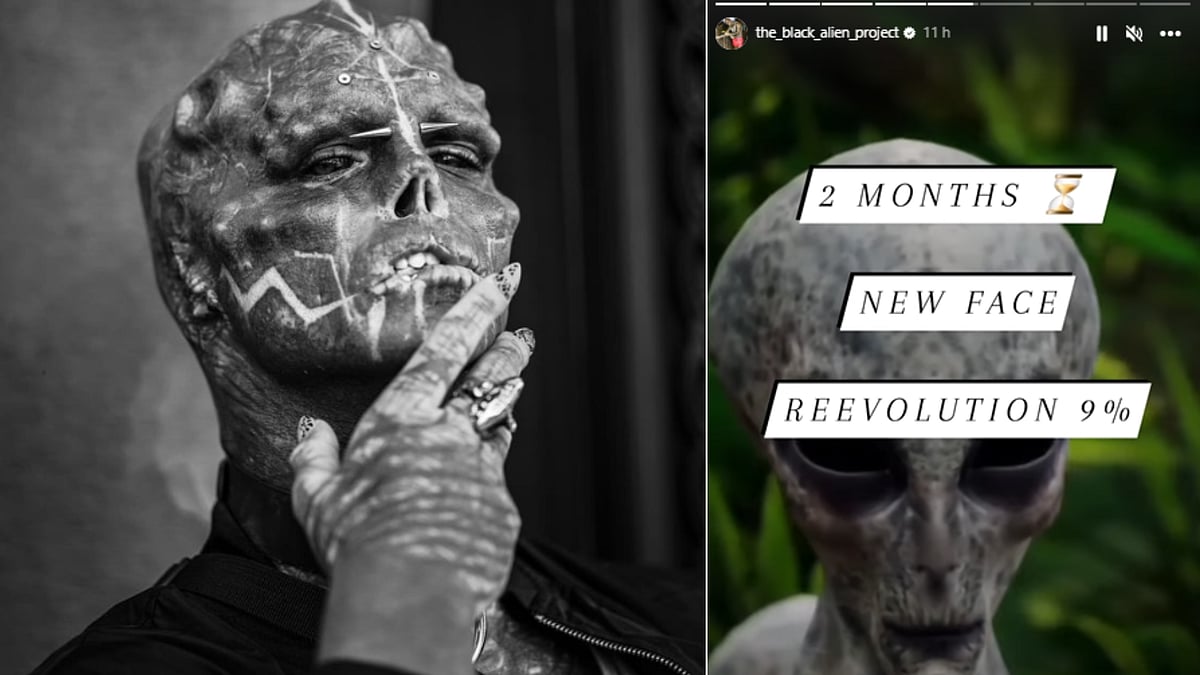 Frenchman reveals he is just 2 months away from transforming into a 'black alien' - Vimarsana News