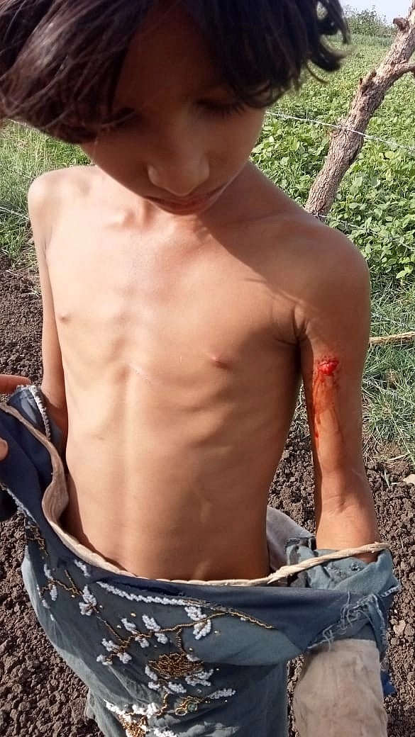 Madhya Pradesh: 5 injured after Leopord barges into residential area in Sehore; foresters on high alert - Vimarsana News