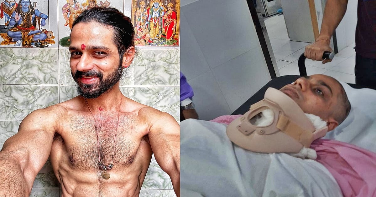 Delhi Shocker: Salman Khan's Yuvvraaj Assistant Director Beaten Up By Group Of Men in Laxmi Nagar, Suffers Serious Injuries; Picture Surfaces - Vimarsana News
