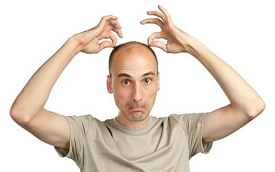 Calling man bald at work is sexual harassment, rules UK tribunal - Vimarsana News