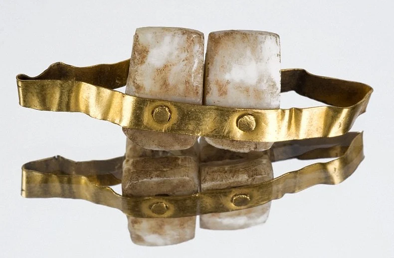 Etruscan dentures