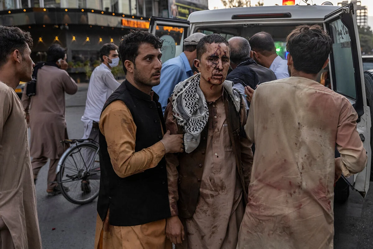 People injured in the two blasts at Kabul International airport (Photo courtsey - The New York Times)